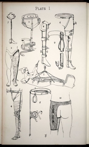 Surgical appliances and instruments h